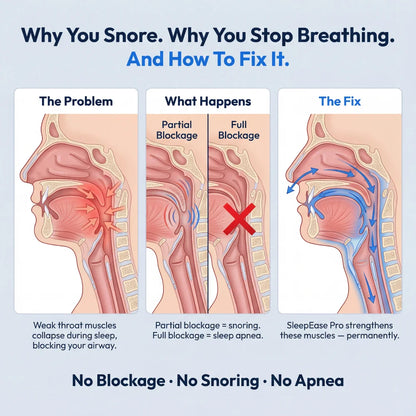 Calm Nights Pro — Eliminates Snoring & Sleep Apnea